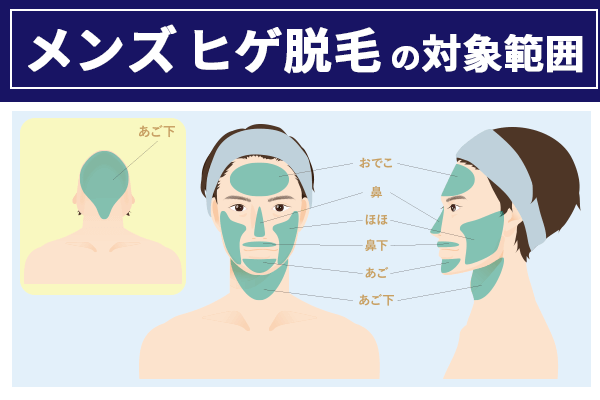 メンズのヒゲ医療脱毛の対象範囲