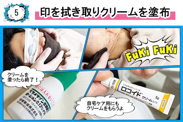 メンズリゼのヒゲ脱毛フロー5