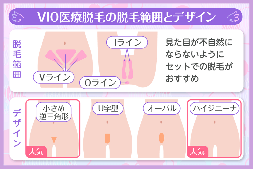 VIO医療脱毛の脱毛範囲と人気デザインをまとめた画像
