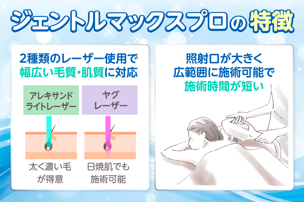 ジェントルマックスプロの特徴を示した図解