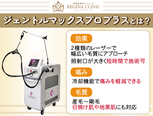 ジェントルマックスプロプラスの特徴