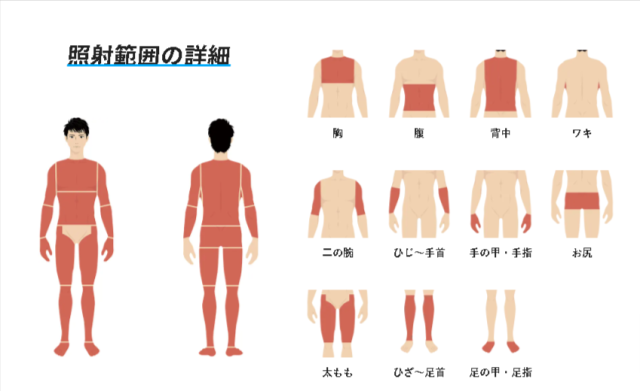 メンズリゼの全身脱毛の照射範囲