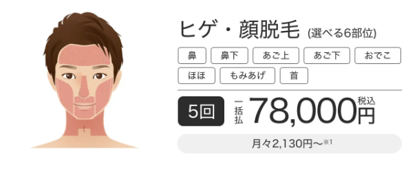 メンズエミナルクリニックのヒゲ・顔脱毛選べる6部位
