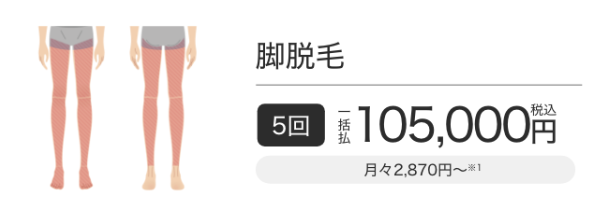 メンズエミナルクリニックの脚脱毛