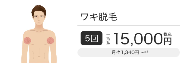 メンズエミナルクリニックのワキ脱毛