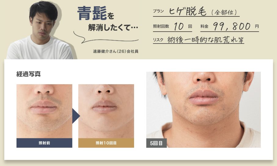 メンズリゼクリニックの症例写真
