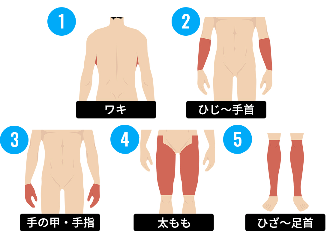 清潔感を保ちたい学生の方向けの脱毛プラン