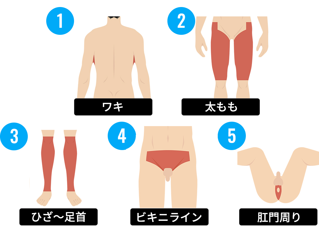 蒸れが気になるスポーツマン向けの脱毛プラン