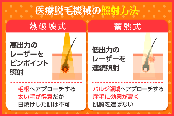 医療脱毛機の照射方法の特徴や違い