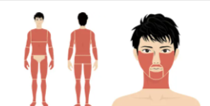 メンズリゼの全身脱毛+ヒゲ脱毛の施術範囲を表す画像