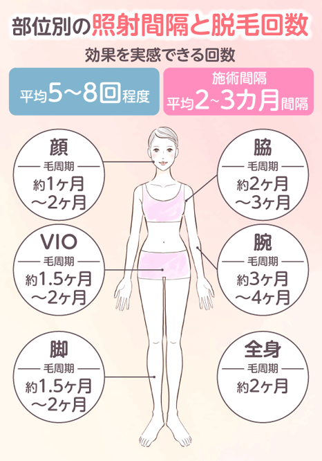 部位ごとの最適な照射間隔と必要な施術回数を表した画像