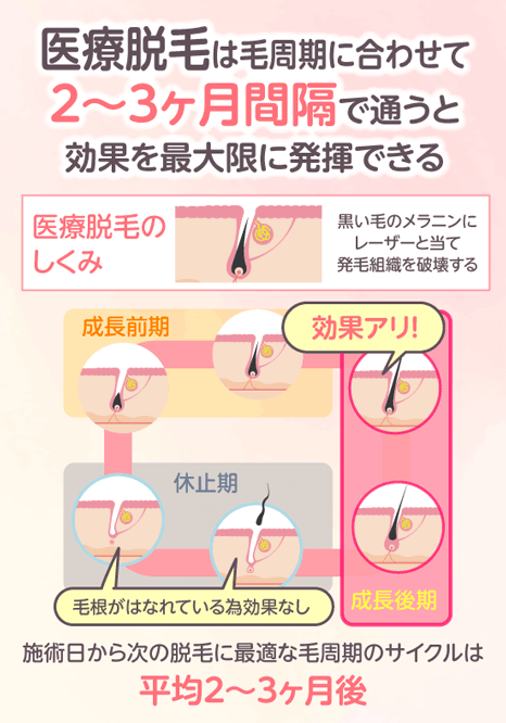 医療脱毛の施術間隔は毛周期に合わせた2~3ヶ月がベスト