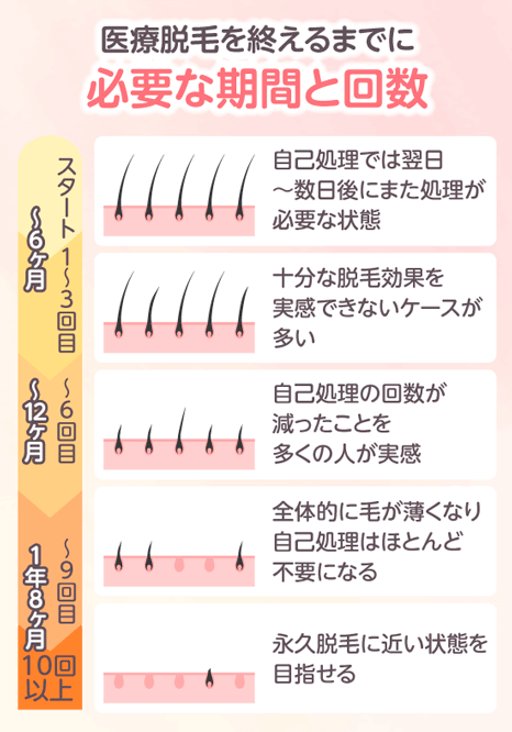 医療脱毛を追えるまでに必要な施術回数と効果を実感できるまでの期間を表した画像