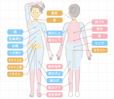 ルシアクリニックの全身＋VIO脱毛箇所