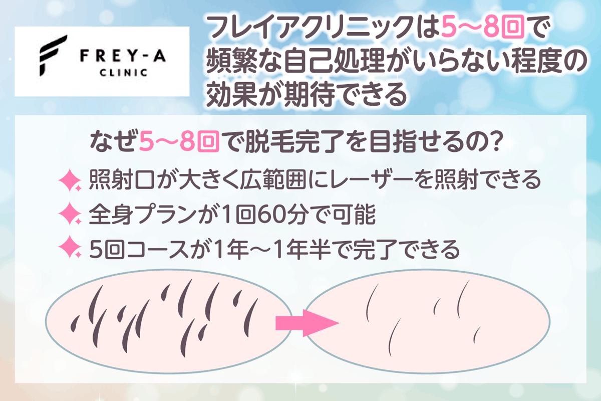 フレイアクリニックは5～8回で頻繁な自己処理がいらない程度の効果が期待できる