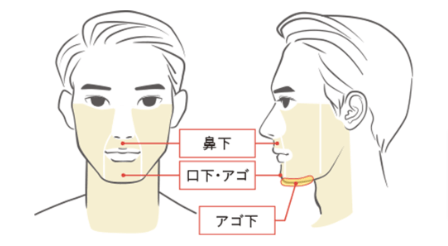 メンズアリシアクリニックのヒゲ脱毛3部位の画像