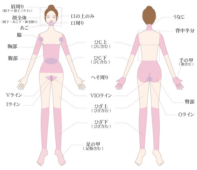 脱毛部位