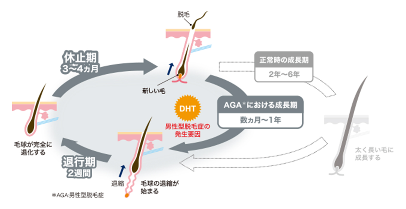 AGAのヘアサイクル