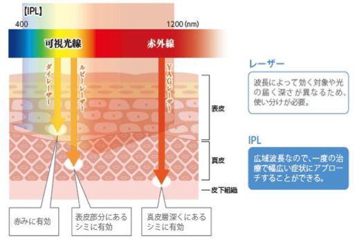 ノーリス（Nordlys）とは