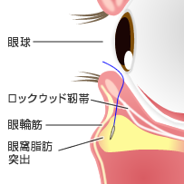 術前・術後の注意