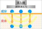 「超音波導入（ソノフォレーシス）」とは