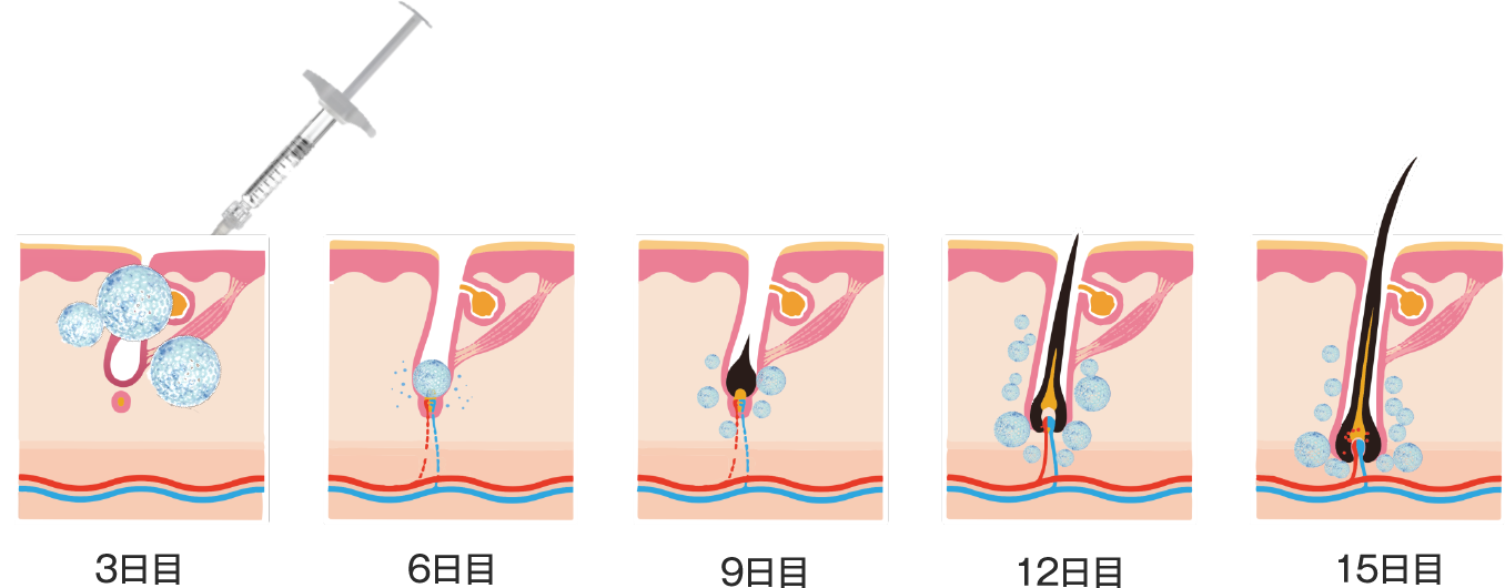 DR.CYJ ヘアフィラーに配合されるペプチド