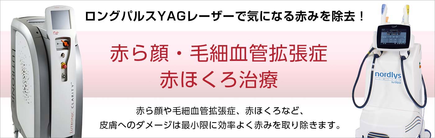 赤ら顔・毛細血管拡張症・赤ほくろ