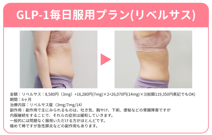 DMMオンラインクリニックのリベルサスの症例画像