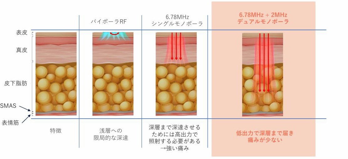 ZERFデュアルモノポーラ