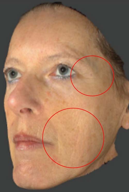 <p><span>after(4クール後)</span></p>
