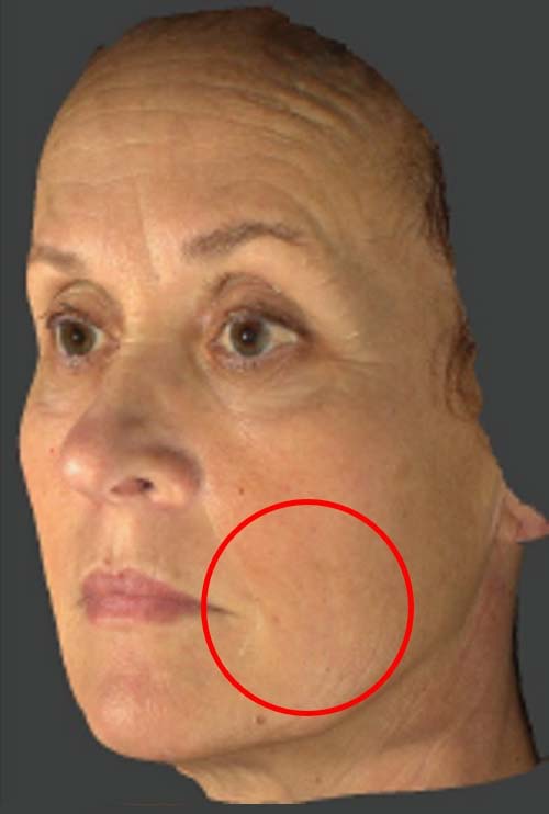 <p><span>after(4クール後)</span></p>
