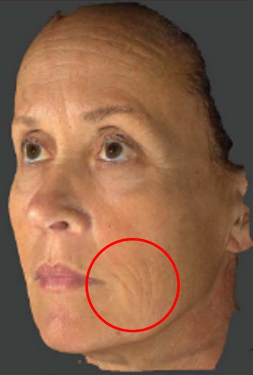 <p><span>before</span></p>
