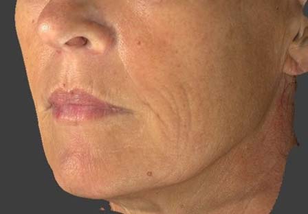 <p><span>before</span></p>
